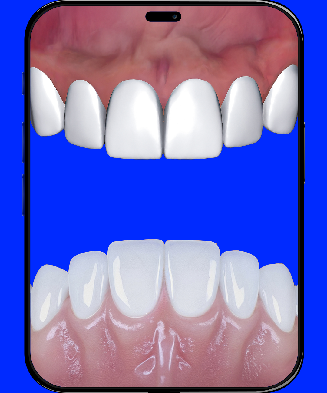 Smile Feature